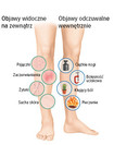 Symptomy wewnętrzne i zewnętrzne