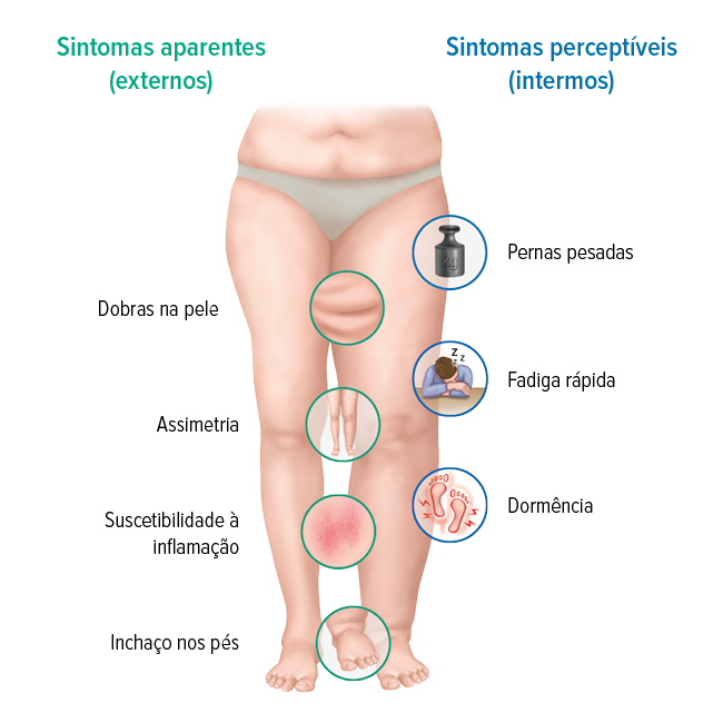 Sintomas do linfedema Sintomas do linfedema