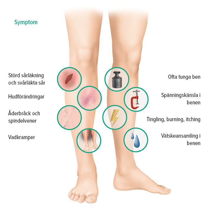 Symptom CVI Symptom CVI