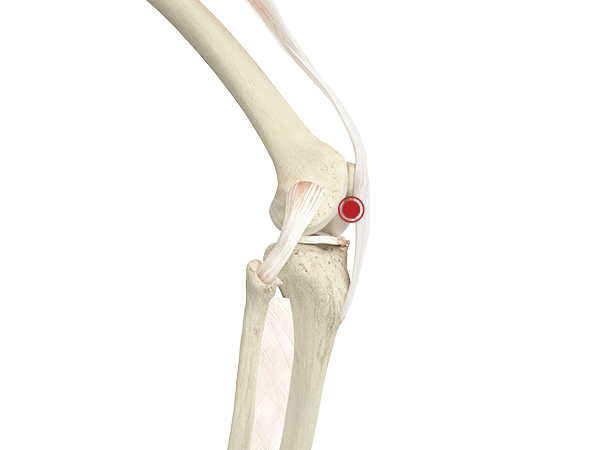 Pointy knee sale cap