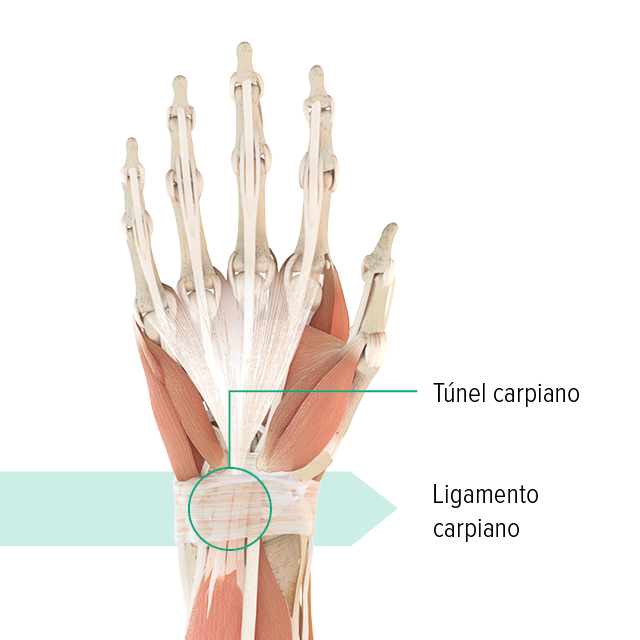 Ilustración anatómica de la mano izquierda en la que se indican el túnel carpiano y el ligamento carpiano