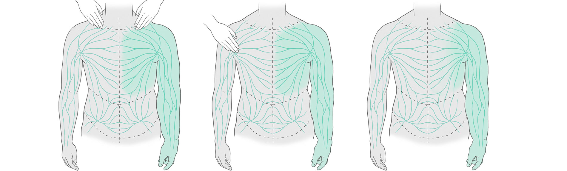 Neue Wissensseite: Manuelle Lymphdrainage