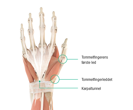 Anatomisk tegning – højre hånd, set fra håndryggen Anatomisk tegning af en hånd: Her kan man se tommelfingerens grundled, tommelfingerens sadelformede led og hvor karpaltunnelen befinder sig