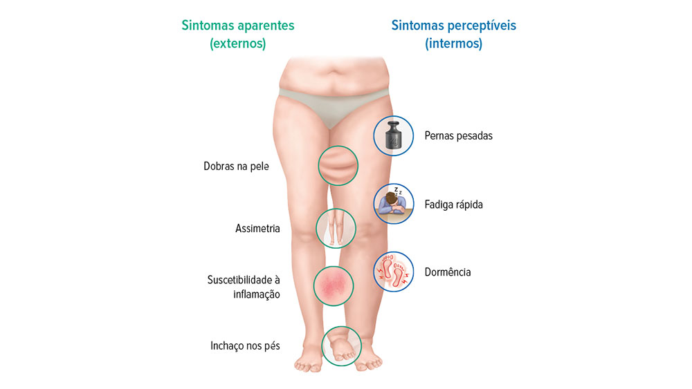 Sintomas do linfedema Sintomas do linfedema