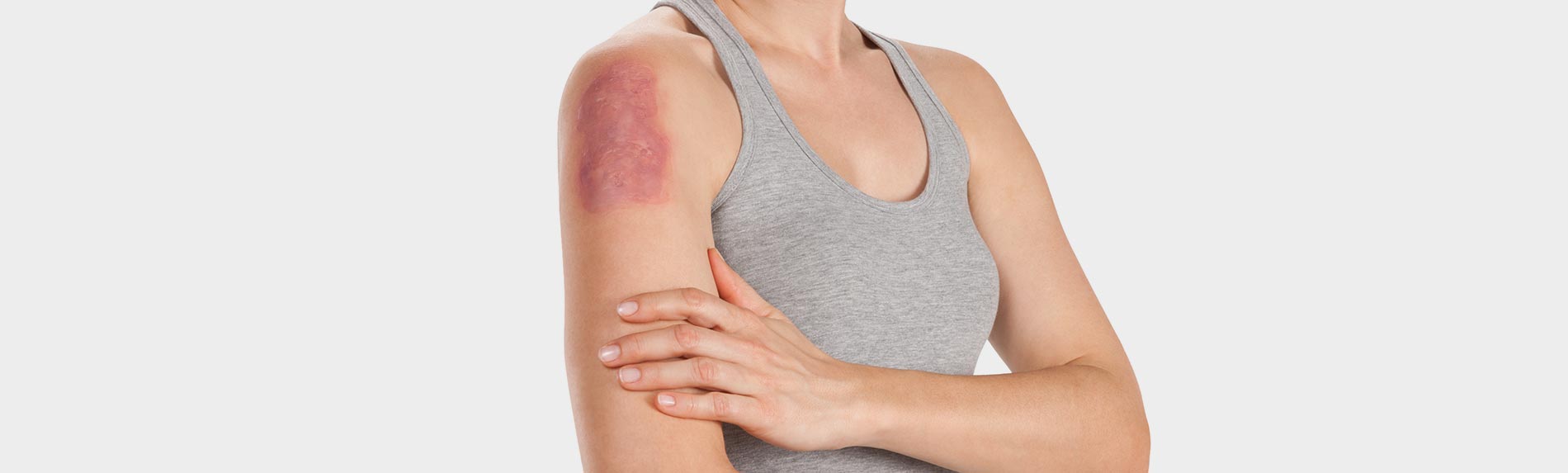 Narben positiv beeinflussen