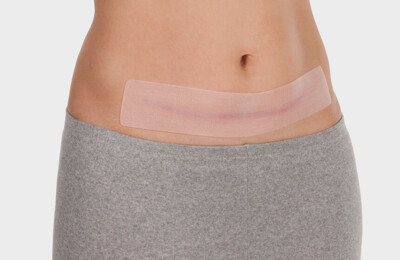 Jetzt NEU: Juzo ScarPad Extra long