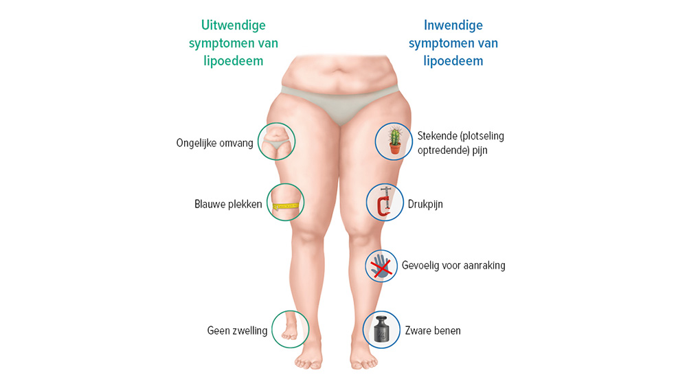 Grafische weergave symptomen lipoedeem