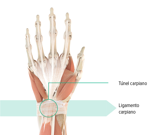 Ilustración anatómica de la mano izquierda en la que se indican el túnel carpiano y el ligamento carpiano