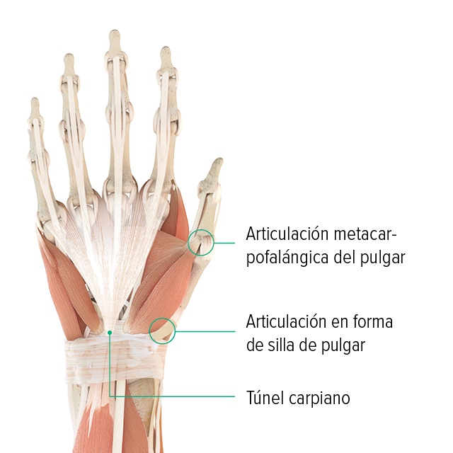 Imagen anatómica de una mano: en ella se pueden apreciar la articulación metacarpofalángica del pulgar, la articulación en silla de montar del pulgar y la ubicación del túnel carpiano.