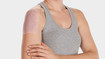 Frau trägt ein Juzo Scarpad auf ihrer Narbe auf dem Oberarm