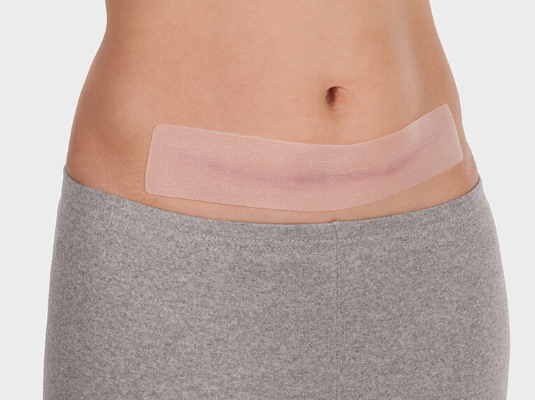 Jetzt NEU: Juzo ScarPad Extra long