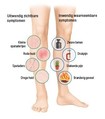 Symptomen in de benen innerlijk en uiterlijk