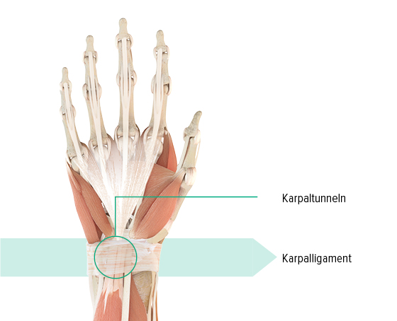 Anatomisk teckning – vänster hand Anatomisk illustration av vänster hand med karpaltunneln och karpalbandet markerade