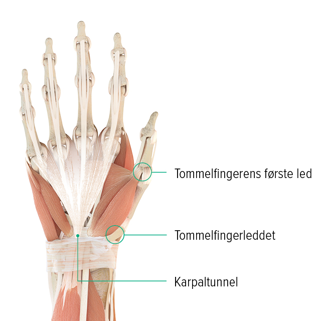 Anatomisk tegning – højre hånd, set fra håndryggen Anatomisk tegning af en hånd: Her kan man se tommelfingerens grundled, tommelfingerens sadelformede led og hvor karpaltunnelen befinder sig