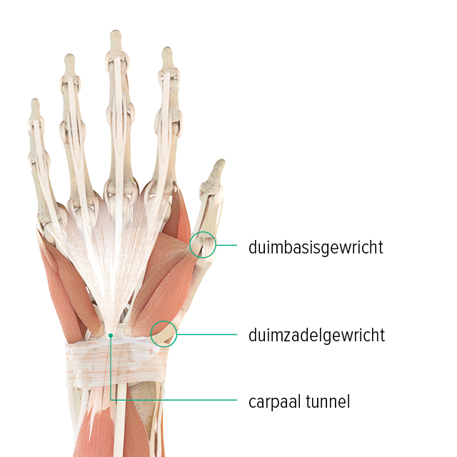 Anatomische afbeelding van een hand: hierop zijn het basale gewricht van de duim, het zadelgewricht van de duim en de locatie van de carpale tunnel te zien